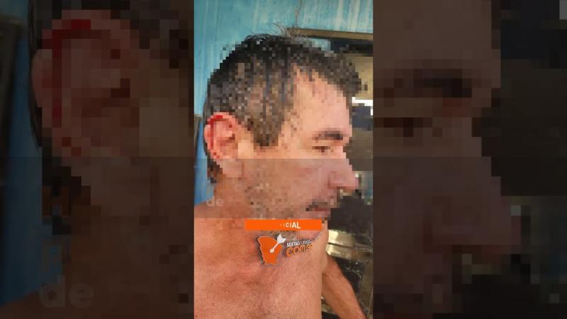 Homem é atingido por disparos de arma de fogo no bairro Alto Guaramiranga, em Canindé