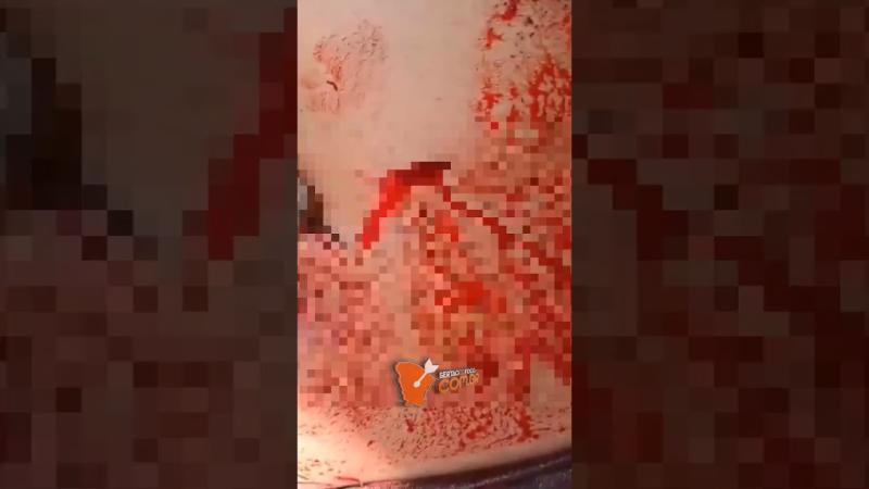 Mulher é lesionada a golpe de faca em bar na zona rural de Canindé